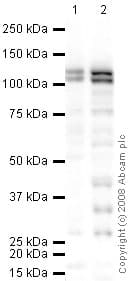 Anti-Ctip2 antibody(AB28448)