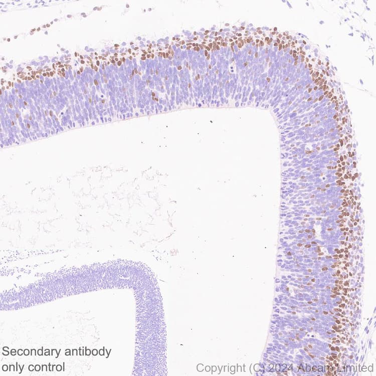 Anti-TBR2 / Eomes antibody [RM2055](AB319166)