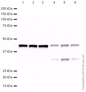 Western blot analysis of beta-Actin in HeLa, Jurkat, and NIH/3T3 cells using mAbcam 8226 antibody.