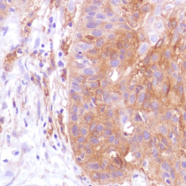 Anti-PD-L1 antibody [SP142] - BSA and Azide free(ab236238)