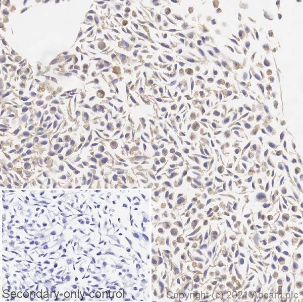 IHC image of BRAF (mutated V600E) staining in a section of formalin-fixed paraffin-embedded A375 cell line (carrying mutant BRAF V600E) performed on a Leica BONDTM system using the standard protocol.