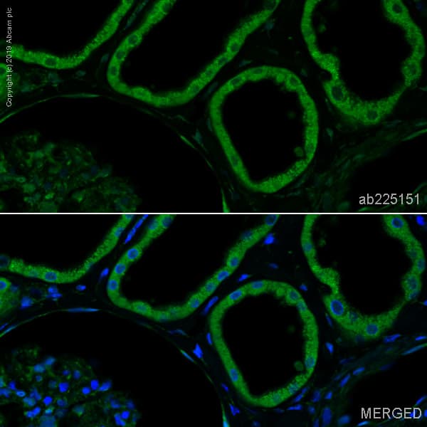Anti-GBA antibody [EPR5143(3)] - BSA and Azide free(AB215260)