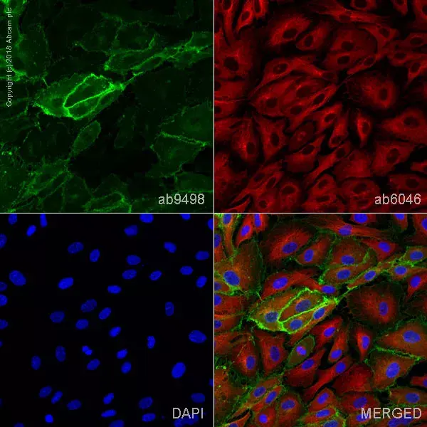 Anti-CD31 antibody [JC/70A](AB9498)
