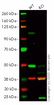 Western blot image showing the specific reaction of anti-Sortilin/NT3 antibody (ab188586) with Sortilin/NT3 protein in wild-type HeLa cells, with a loss of signal in SORT1 knockout HeLa cells.