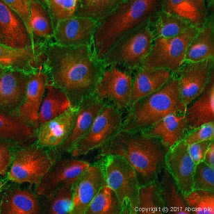 Immunocytochemistry image showing anti-CD31 antibody [JC/70A] (ab9498) staining in HUVEC cells