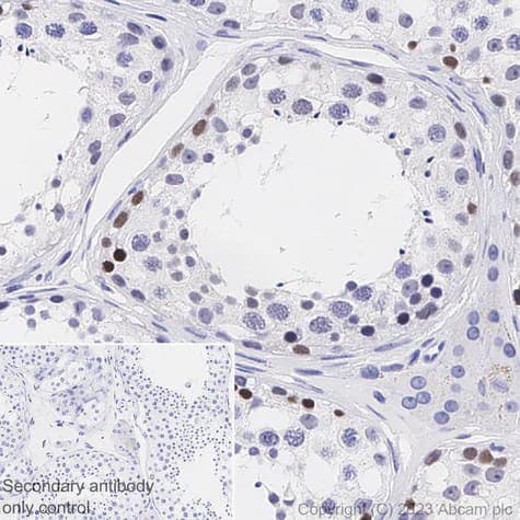 Immunohistochemistry (Formalin/PFA-fixed paraffin-embedded sections) - Anti-PRAME antibody [EPR20330] (ab219650)