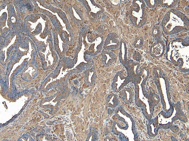 Anti-VPS35 antibody(AB10099)