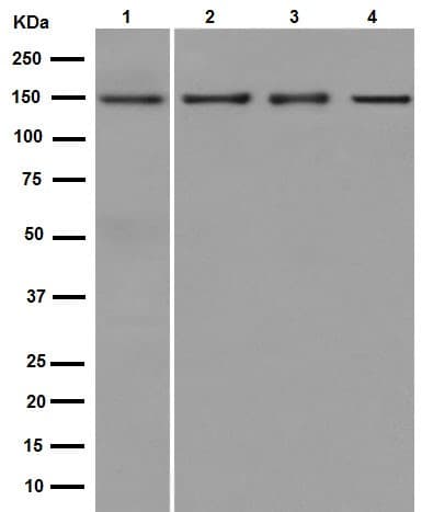 Anti-Collagen VI antibody [EPR17072](AB182744)