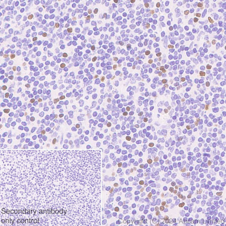 Anti-TBR2 / Eomes antibody [RM2055](AB319166)