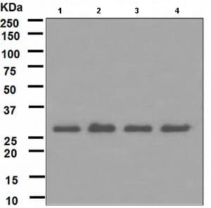 Anti-RPA32/RPA2 antibody [EPR2876(2)](AB109084)