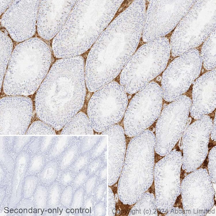 Avidin/Biotin Blocking Kit(ab64212)