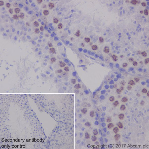 Immunohistochemical analysis of paraffin-embedded mouse testis tissue labeling p21 with ab188224 at 1/1000 dilution, followed by goat anti-rabbit IgG H&L (HRP) (ab97051) at 1/500 dilution.