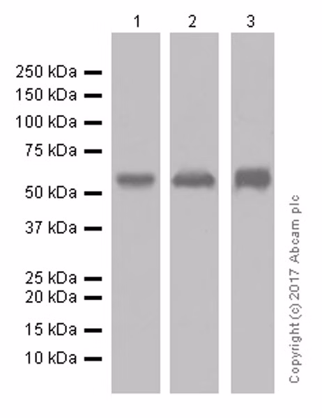 Western blot analysis of human, rat, and mouse skin lysates using anti-Cytokeratin 5 antibody.
