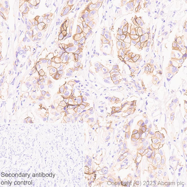 Anti-Somatostatin Receptor 2 antibody [UMB1] - BSA and Azide free(AB271907)