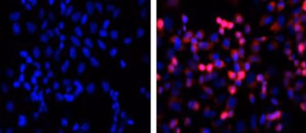 Untransfected and His-tagged fusion protein cells stained with anti-His antibody and DAPI.