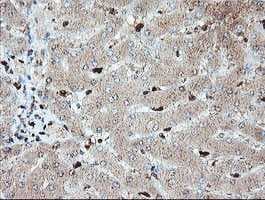 Samhd1 Antibody Oti1a1 Ab128107  Immunohistochemistry Formalin Pfa Fixed Paraffin Embedded Sections Img110317
