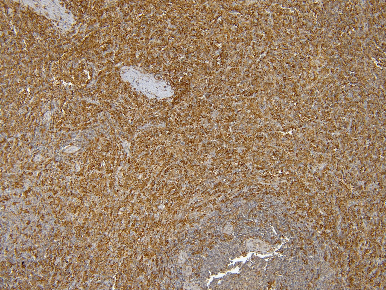 Immunohistochemistry staining of human spleen tissue showing Iba1-positive cells using ab5076 antibody.