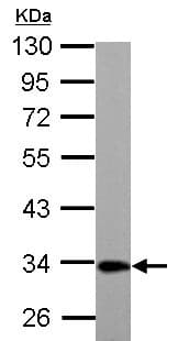 Etfa Antibody Ab153722  Western Blot Img161277