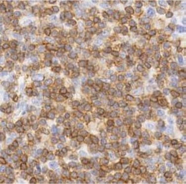 Anti-CD3 epsilon antibody [SP7], prediluted(AB21703)