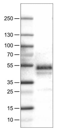 Carbonic Anhydrase 12 Ca12 Antibody Cl0278 Ab242316  Western Blot Img77609