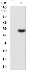 Anti-G-CSF antibody [7E4F7](AB204989)