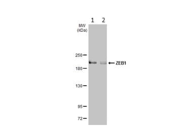 Anti-ZEB1 antibody(AB155249)
