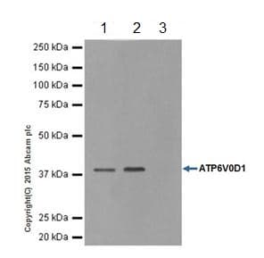 Anti-ATP6V0D1/P39 antibody [EPR18320-38](AB202899)