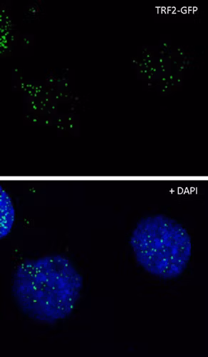 Immunocytochemistry - Anti-GFP antibody (ab290)