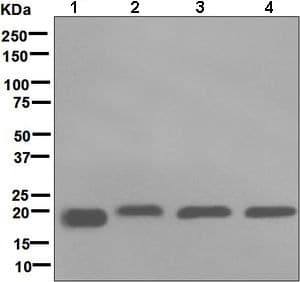 Rbp4 Antibody Epr5879 Bsa And Azide Free Ab248553  Western Blot Img115392