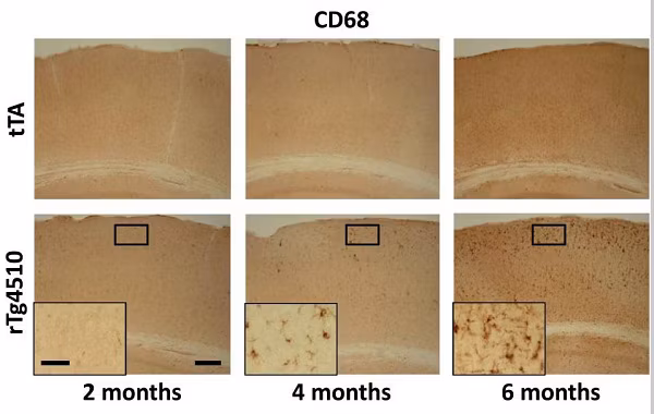 CD68 staining in mouse brain microglia increases with age in rTg4510 animals.