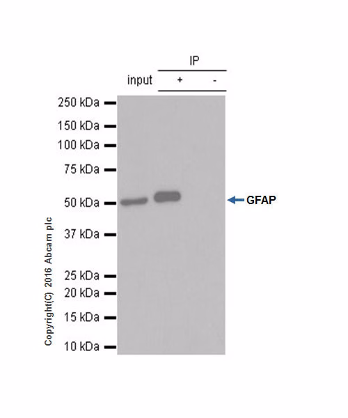 ab68428 at 1/20 dilution immunoprecipitating GFAP in rat brain whole cell lysate observed at 50 KDa (lanes 1 and 2). Lane 1 (input): rat brain whole cell lysate 10ug Lane 2 (+): ab68428 + rat brain whole cell lysate Lane 3 (-): rabbit monoclonal IgG (ab172730) instead of ab68428 in rat brain whole cell lysate
