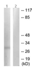 Mmp7 Antibody C Terminal Ab189277  Western Blot Img92910