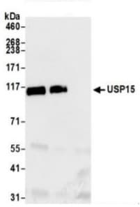 Usp15 Antibody Ab71713  Immunoprecipitation Img169843
