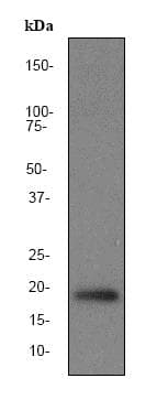 Pin1 Antibody Ep1479y Ab76309  Western Blot Img31256