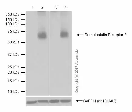 Anti-Somatostatin Receptor 2 antibody [UMB1] - C-terminal(AB134152)