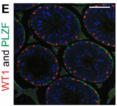 Immunohistochemistry (Formalin/PFA-fixed paraffin-embedded sections) - Anti-Wilms Tumor Protein antibody [CAN-R9(IHC)-56-2] (ab89901). Spermatogenic phenotypes of Rnf8;Scml2-dKO mice.