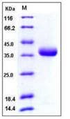 Recombinant Human Prolactin Receptor/PRL-R protein (His tag)(AB276239)