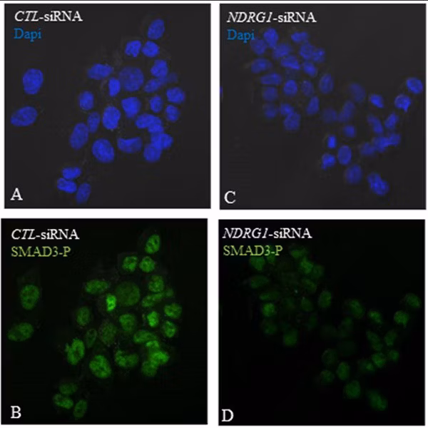TGF-beta1 signaling is impaired in NDRG1-silenced mouse embryonic fibroblasts.