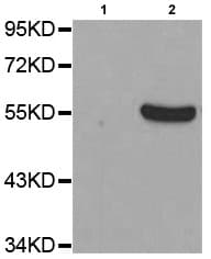Anti-Tyrosine Hydroxylase (phospho S31) antibody(AB194760)