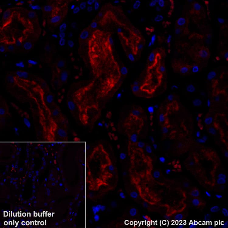 Alexa Fluor® 555 Anti-Folate Binding Protein/FBP antibody [EPR20277](ab309247)