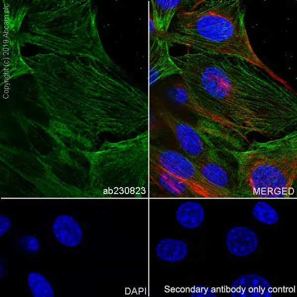 Anti-non-muscle Myosin IIB/MYH10 antibody [EPR22564-23](AB230823)