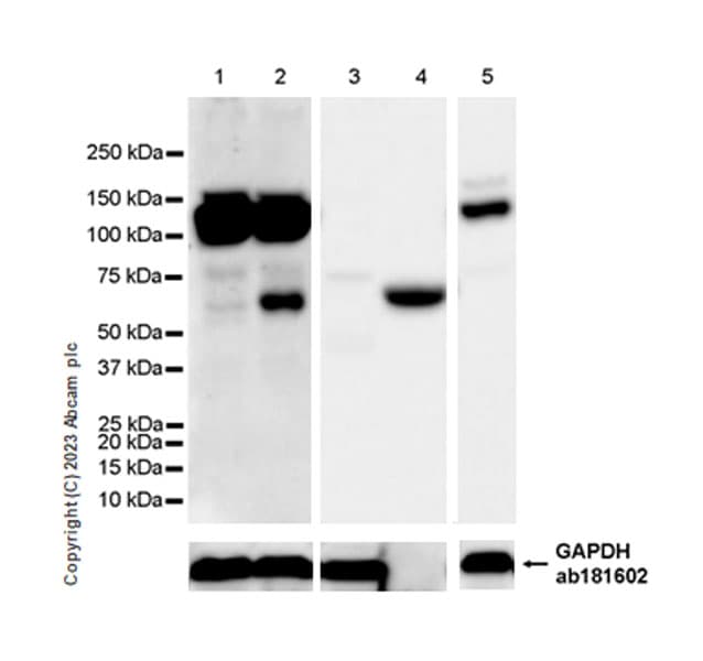 Smoc1 Antibody Epr26922 31 Ab313571  Western Blot Img418208