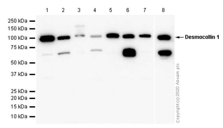 Anti-Desmocollin 1 antibody [EPR8220](AB150382)