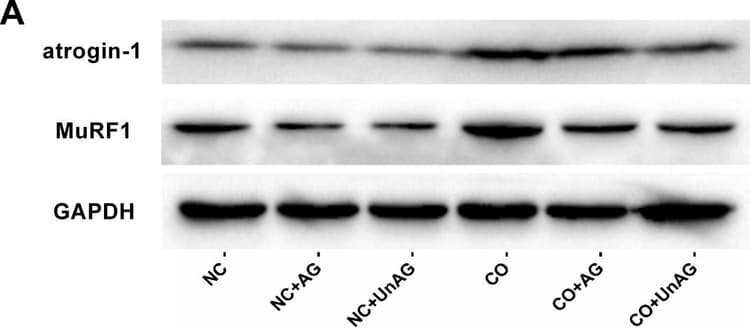 Anti-Fbx32 antibody [EPR9148(2)](AB168372)