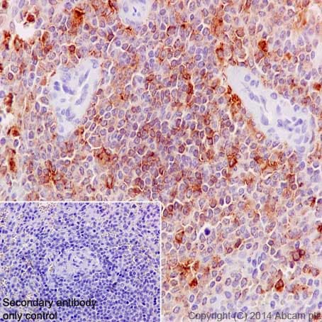 Anti-MMP9 antibody [EP1254](AB76003)