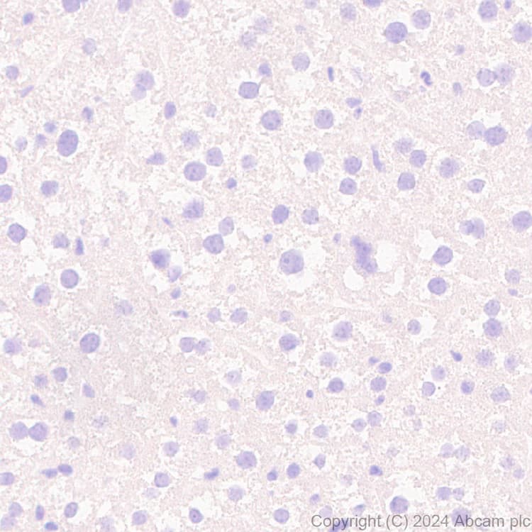 Pai1 Antibody Epr21850 262 Bsa And Azide Free Ab317605  Immunohistochemistry Formalin Pfa Fixed Paraffin Embedded Sections Img431903