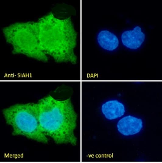 Siah1 Antibody Ab2237  Immunocytochemistry Immunofluorescence Img403703