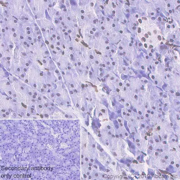 Anti-Histone H3 (acetyl K27) antibody [EP16602] - ChIP Grade(AB177178)