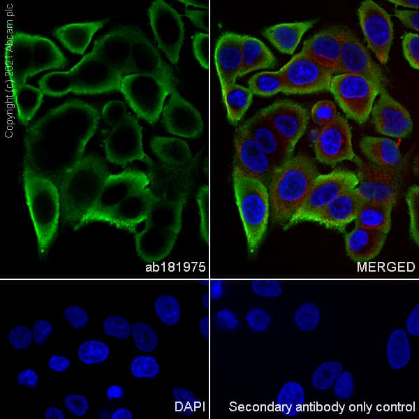 S100 Alpha 6 Pra Antibody Epr13084 69 Bsa And Azide Free Ab250543  Immunocytochemistry Immunofluorescence Img173876