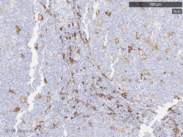 Macrophage Polarization Panel - Human IHC(ab278180)